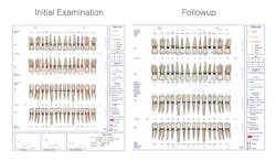 Figure 2: Voice-activated periodontal chart, before and after. Note the obvious improvement in the patient’s periodontal condition. Photo courtesy of Salem Dental Arts Figure 2: Voice-activated periodontal chart, before and after. Note the obvious improvement in the patient’s periodontal condition. Photo courtesy of Salem Dental Arts