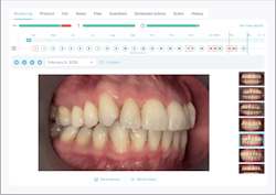 Software interface showing image of teeth. Software interface showing image of teeth.