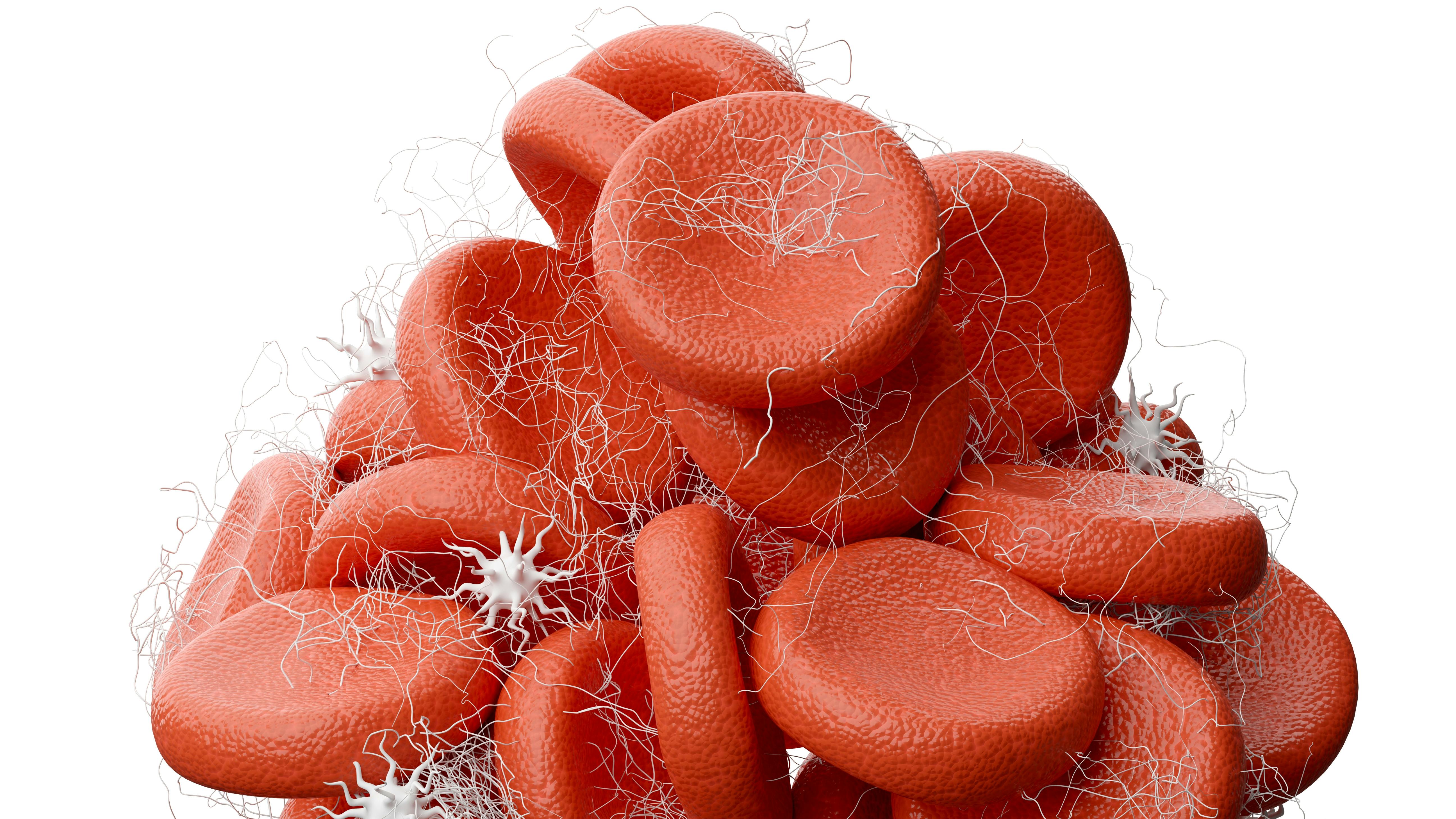 blood clot and red blood cells