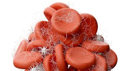 blood clot and red blood cells blood clot and red blood cells