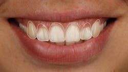 a smile with teeth outlined a smile with teeth outlined