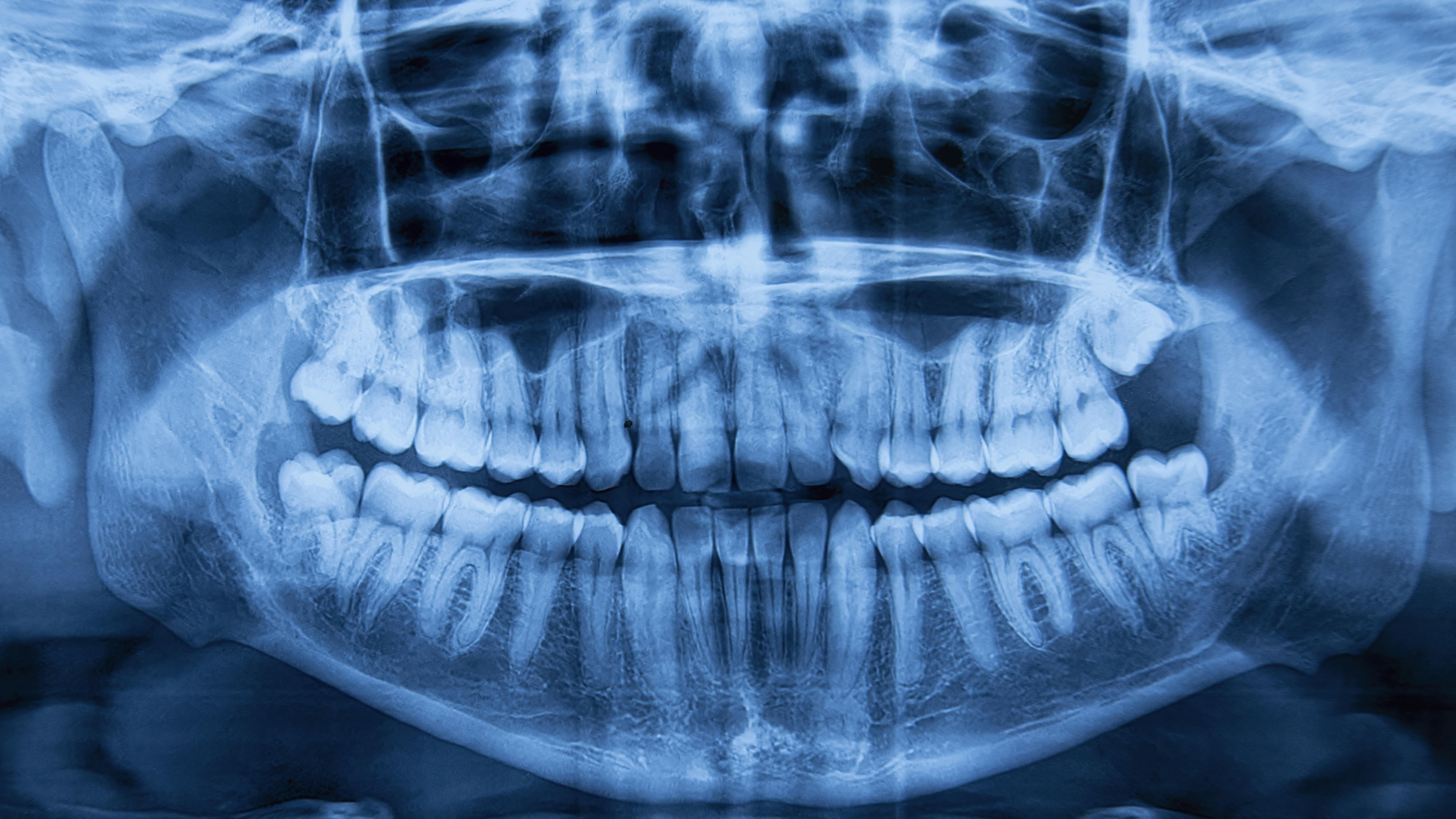 Dental radiograph