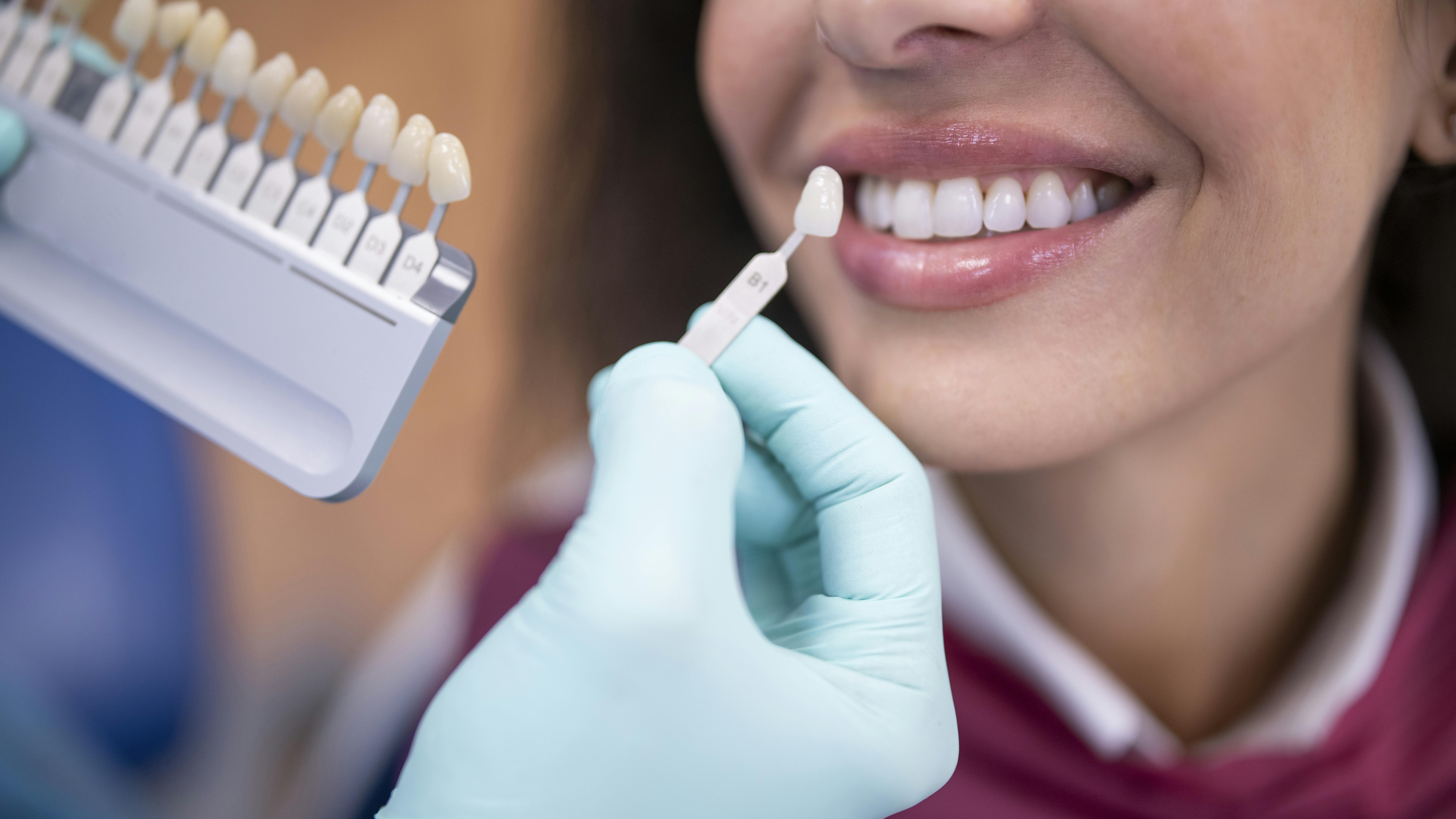 Patient getting their teeth whitened