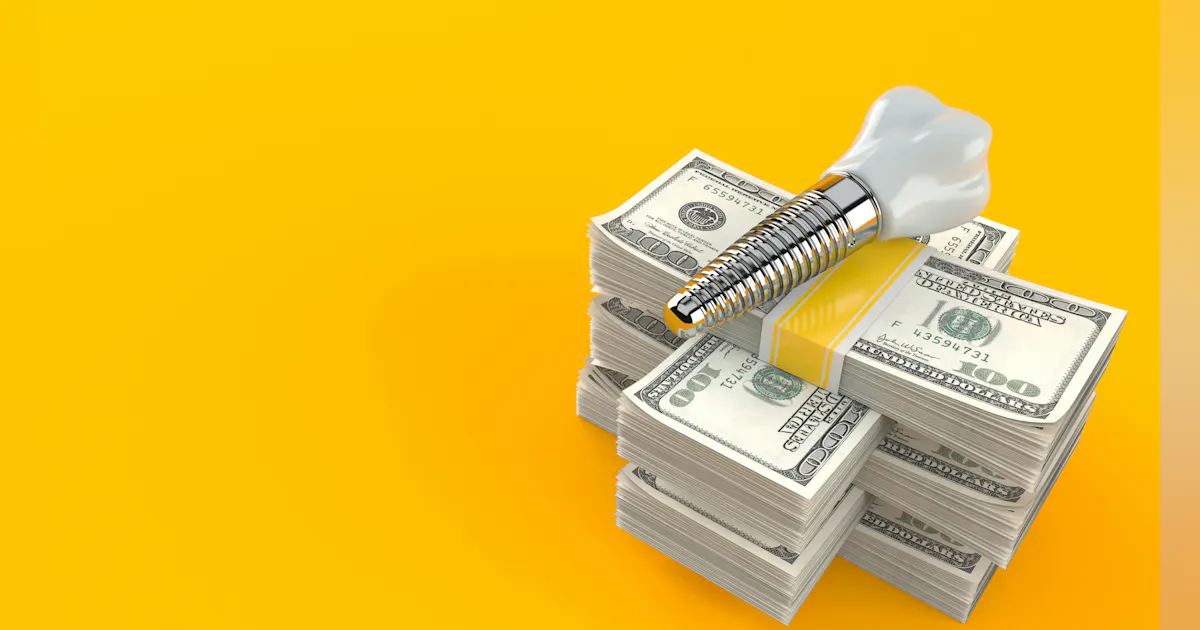 A comparative analysis of dental implant costs across major US markets ...