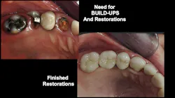 teeth before and after treatment teeth before and after treatment