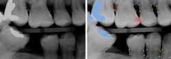 AI radiographs AI radiographs