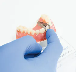 dental matrix system
