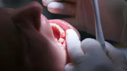 patient with bleeding gums
