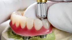 preventing peri-implant disease